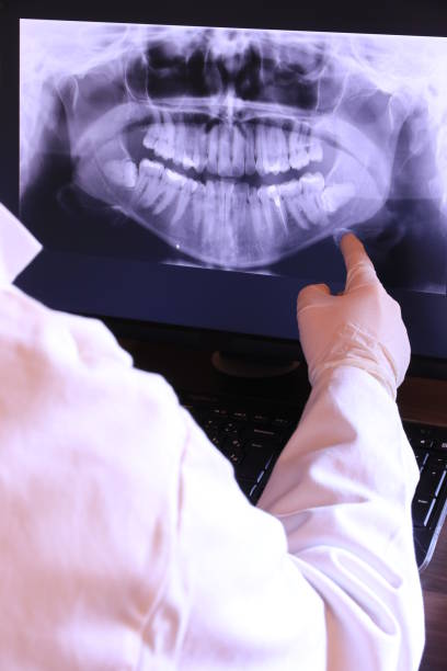 Best Emergency Root Canal Therapy in Salisbury, NC