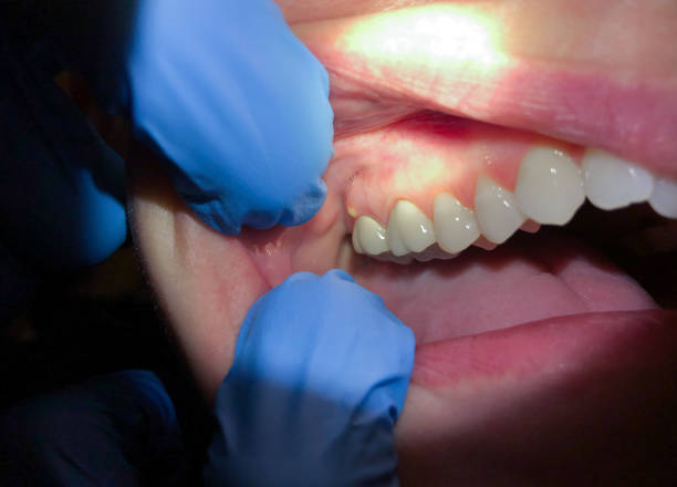 Best Urgent Dental Care for Toothaches in Salisbury, NC