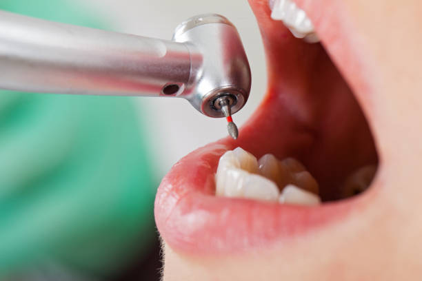 Best Weekend Emergency Dental Services in Salisbury, NC